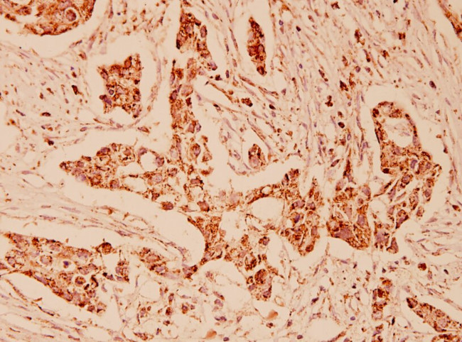 HSPA9 Antibody in Immunohistochemistry (Paraffin) (IHC (P))