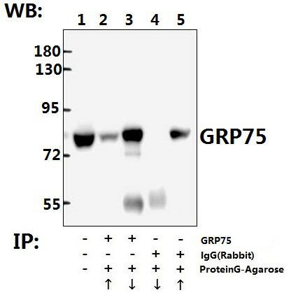 HSPA9 Antibody in Immunoprecipitation (IP)