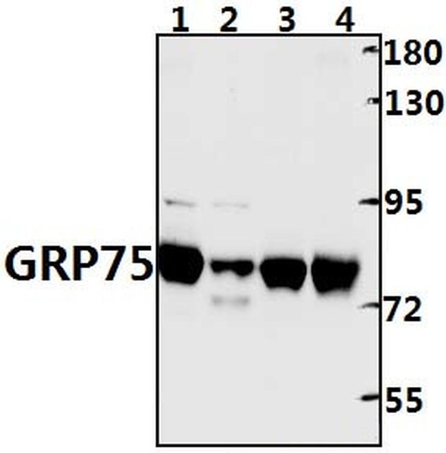 HSPA9 Antibody in Western Blot (WB)