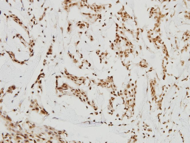 HDAC8 Antibody in Immunohistochemistry (Paraffin) (IHC (P))