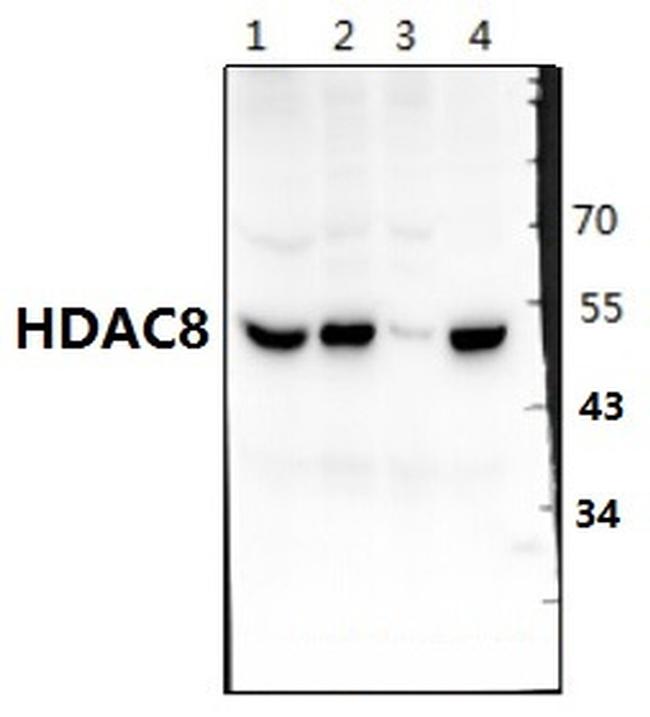 HDAC8 Antibody in Western Blot (WB)