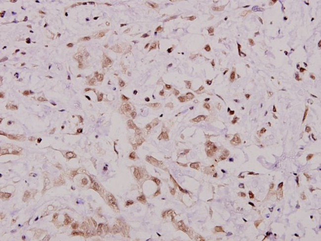 IKK alpha Antibody in Immunohistochemistry (Paraffin) (IHC (P))