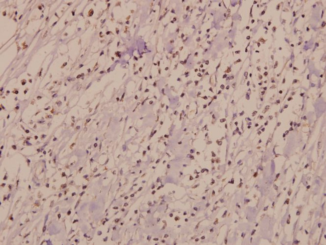 CSF2RB Antibody in Immunohistochemistry (Paraffin) (IHC (P))