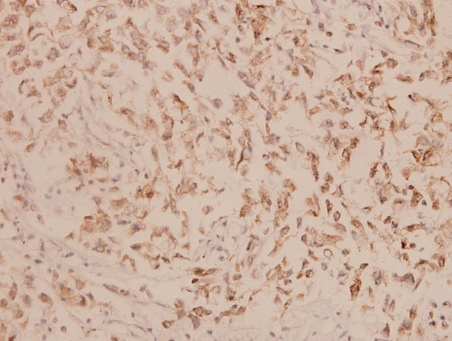 Involucrin Antibody in Immunohistochemistry (Paraffin) (IHC (P))