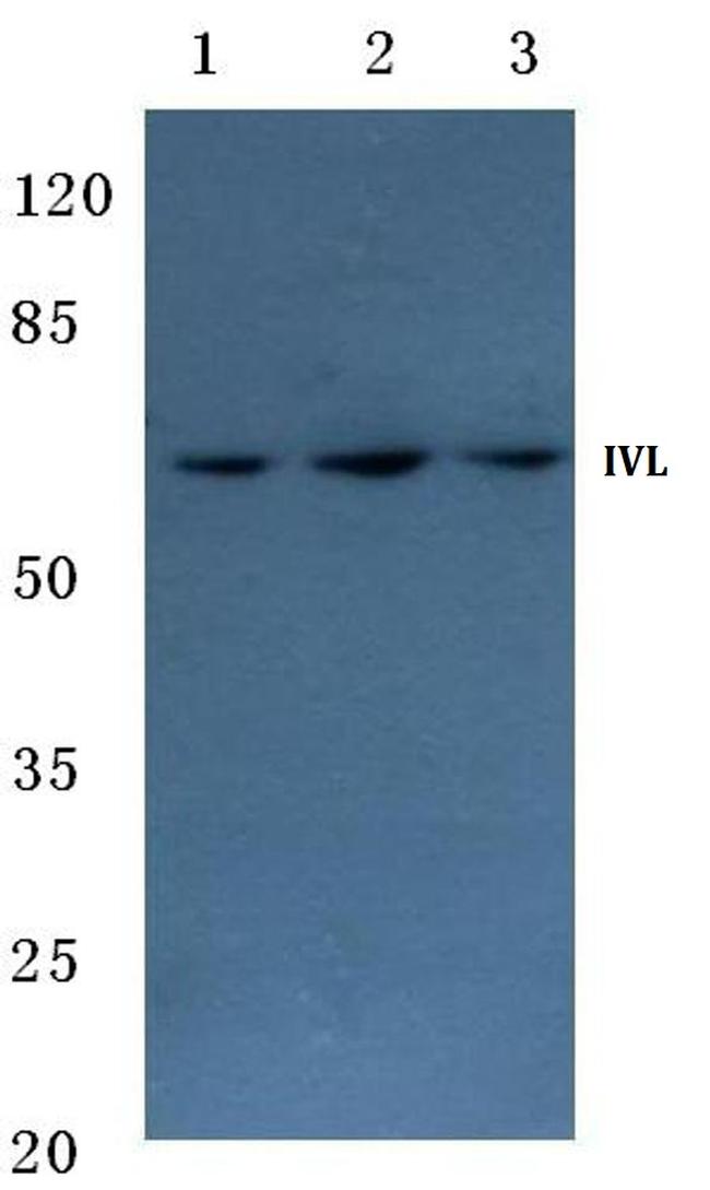 Involucrin Antibody in Western Blot (WB)