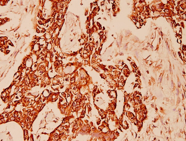 Cytokeratin 10 Antibody in Immunohistochemistry (Paraffin) (IHC (P))