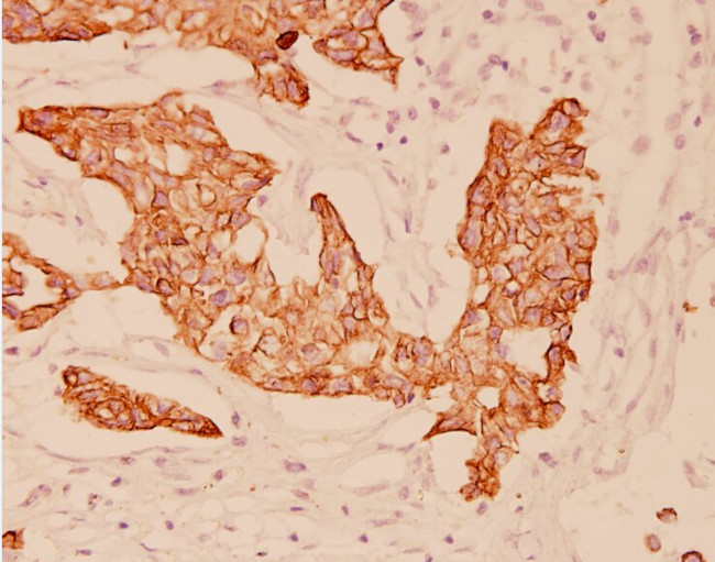 Cytokeratin 20 Antibody in Immunohistochemistry (Paraffin) (IHC (P))