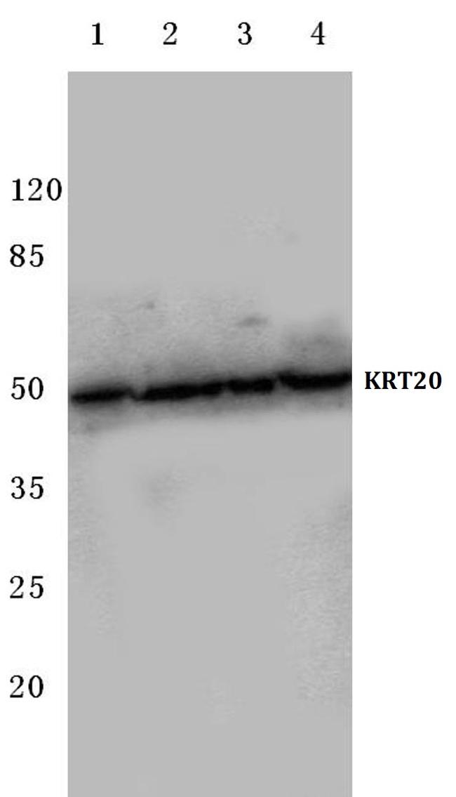 Cytokeratin 20 Antibody in Western Blot (WB)