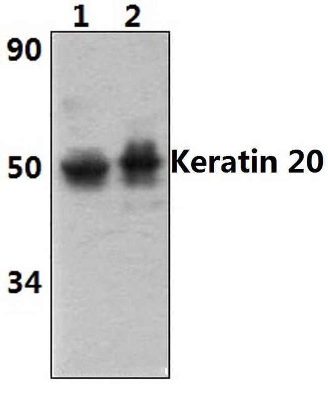 Cytokeratin 20 Antibody in Western Blot (WB)