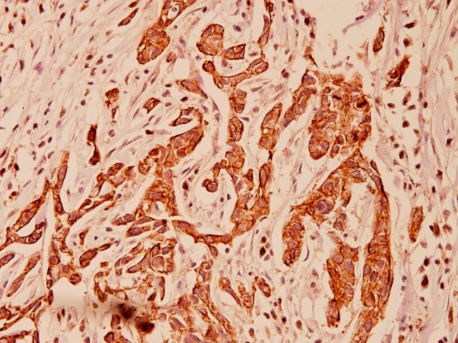 Cytokeratin 5 Antibody in Immunohistochemistry (Paraffin) (IHC (P))