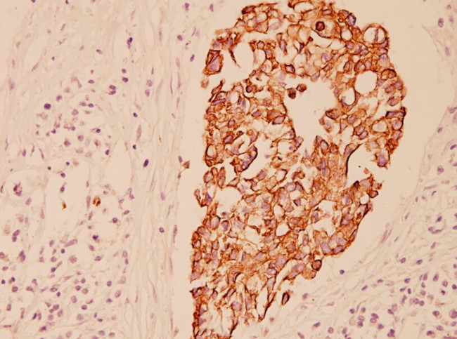 Cytokeratin 7 Antibody in Immunohistochemistry (Paraffin) (IHC (P))