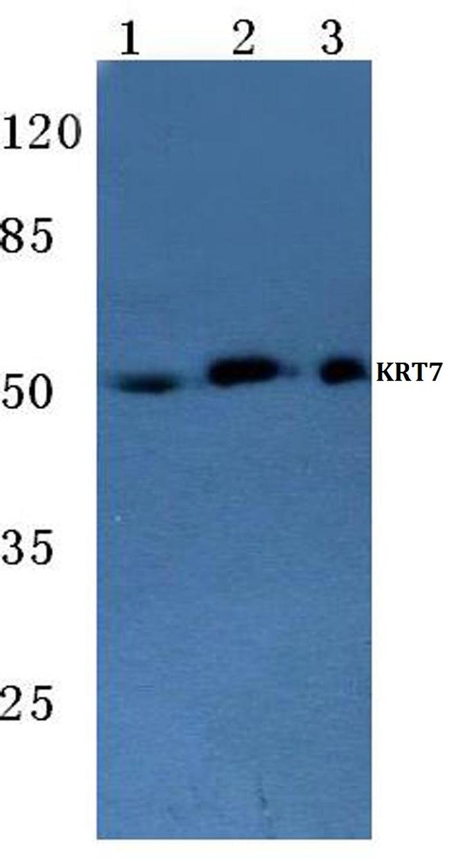 Cytokeratin 7 Antibody in Western Blot (WB)