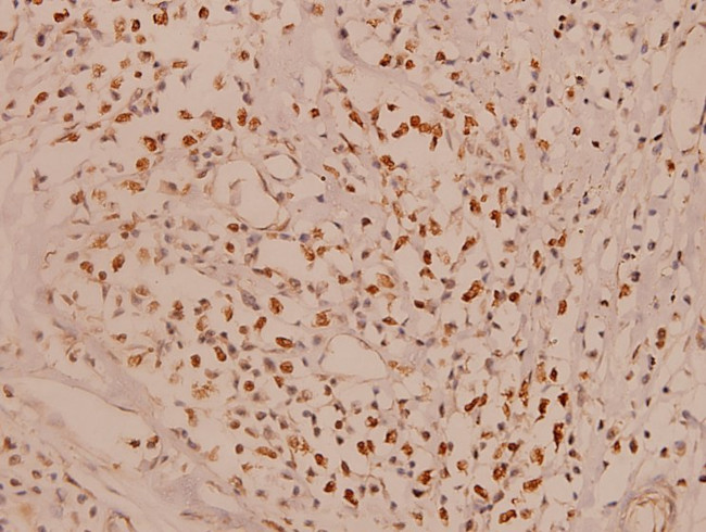 MCL-1 Antibody in Immunohistochemistry (Paraffin) (IHC (P))