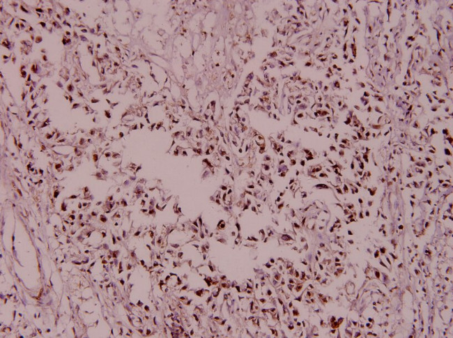 MCM2 Antibody in Immunohistochemistry (Paraffin) (IHC (P))