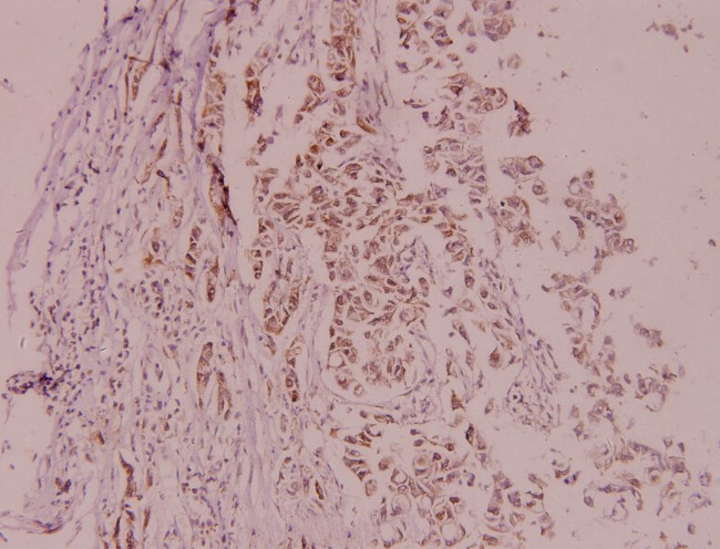 MDM2 Antibody in Immunohistochemistry (Paraffin) (IHC (P))