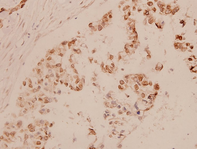 MEF2A Antibody in Immunohistochemistry (Paraffin) (IHC (P))