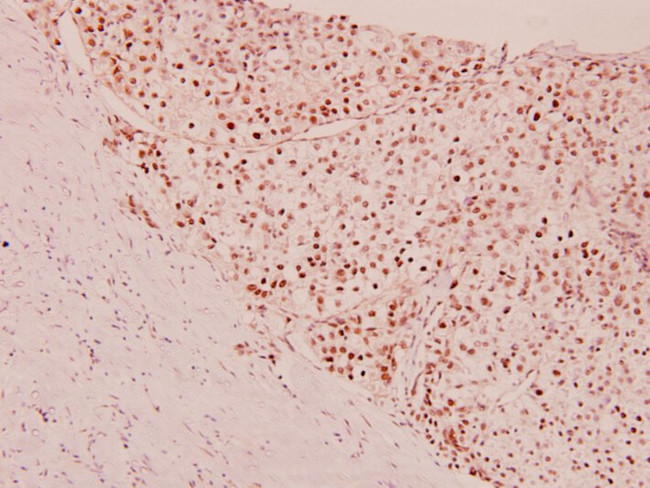 MEF2A Antibody in Immunohistochemistry (Paraffin) (IHC (P))