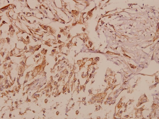 MMP16 Antibody in Immunohistochemistry (Paraffin) (IHC (P))