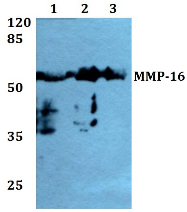 MMP16 Antibody in Western Blot (WB)