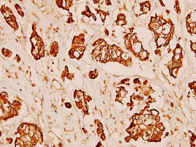 MMP3 Antibody in Immunohistochemistry (Paraffin) (IHC (P))