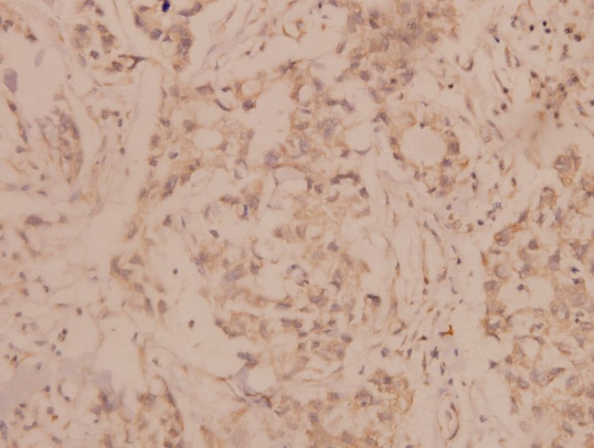 MMP8 Antibody in Immunohistochemistry (Paraffin) (IHC (P))