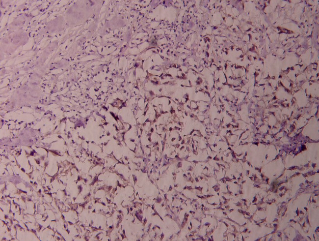 NFkB p52 Antibody in Immunohistochemistry (Paraffin) (IHC (P))