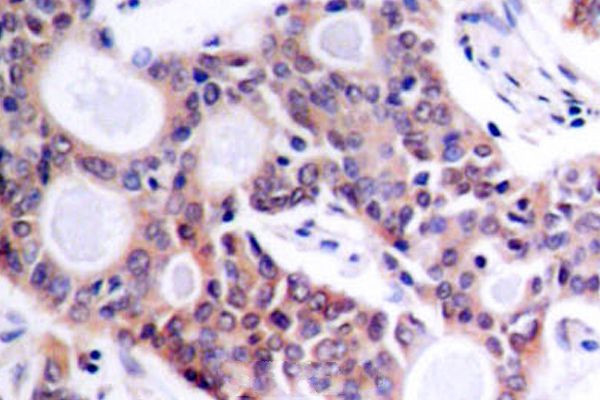 NFkB p52 Antibody in Immunohistochemistry (Paraffin) (IHC (P))