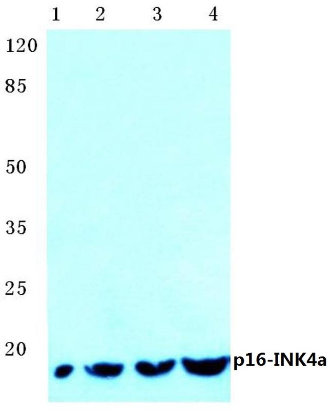 p16INK4a Antibody in Western Blot (WB)