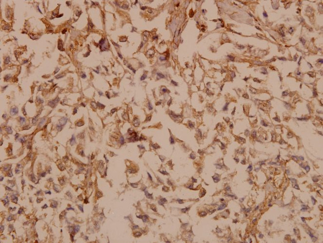 PDGF-B Antibody in Immunohistochemistry (Paraffin) (IHC (P))