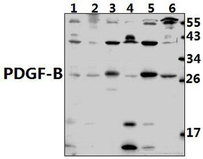 PDGF-B Antibody in Western Blot (WB)