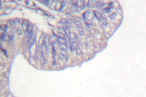 PLCG1 Antibody in Immunohistochemistry (Paraffin) (IHC (P))