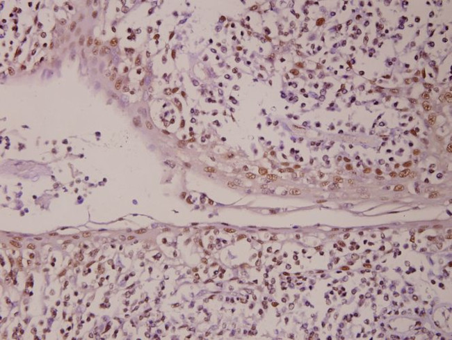 PML Antibody in Immunohistochemistry (Paraffin) (IHC (P))