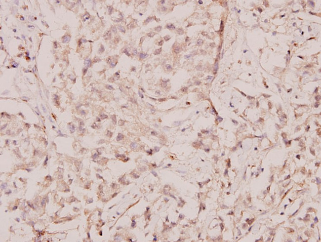 c-Rel Antibody in Immunohistochemistry (Paraffin) (IHC (P))