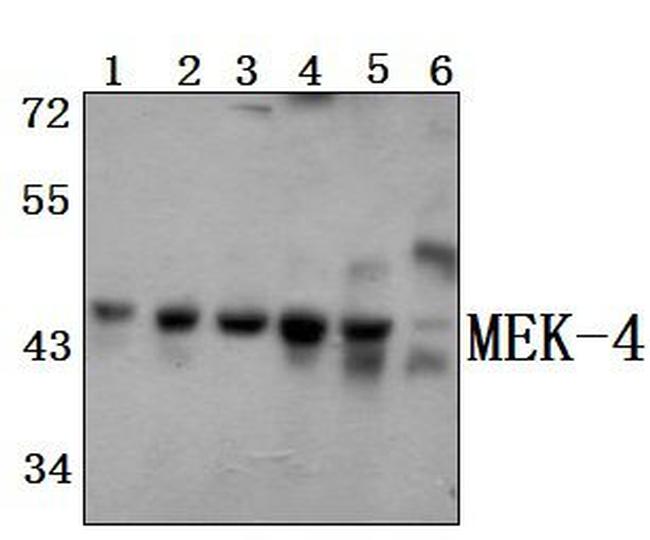 MAP2K4 Antibody in Western Blot (WB)