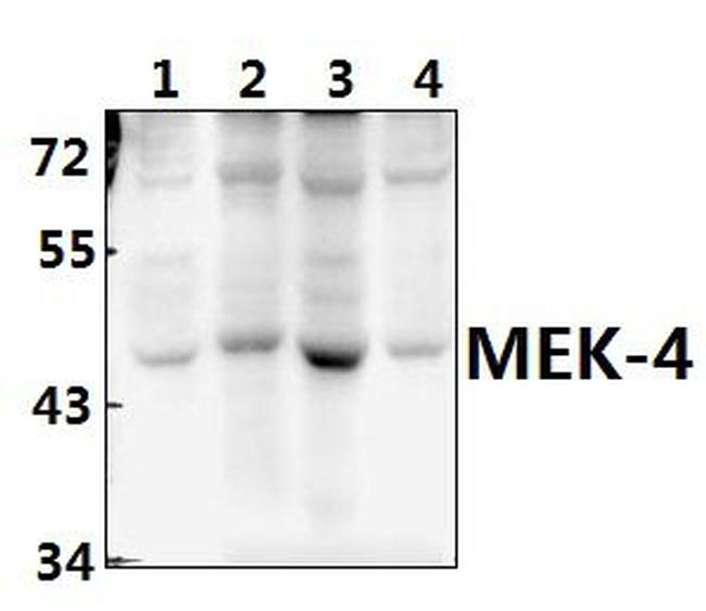 MAP2K4 Antibody in Western Blot (WB)