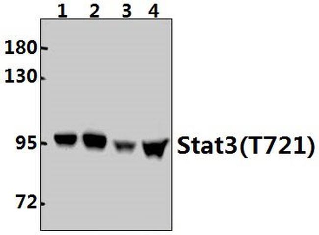 STAT3 Antibody in Western Blot (WB)