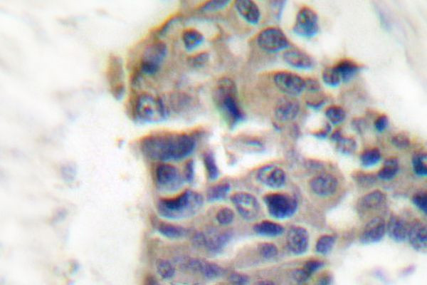 Synaptotagmin 1 Antibody in Immunohistochemistry (Paraffin) (IHC (P))