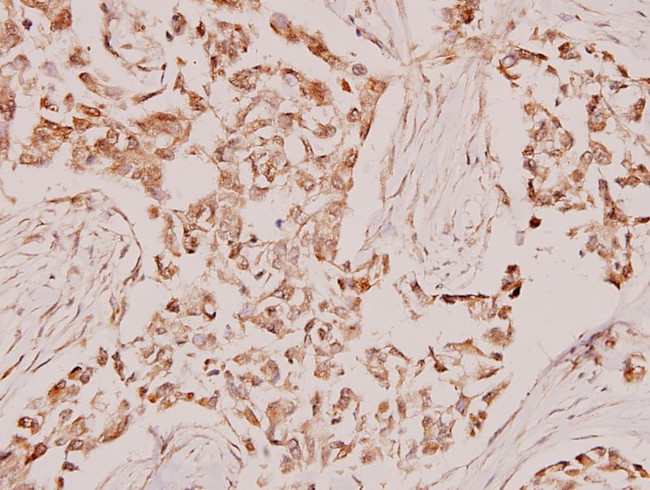 Synaptotagmin 1 Antibody in Immunohistochemistry (Paraffin) (IHC (P))