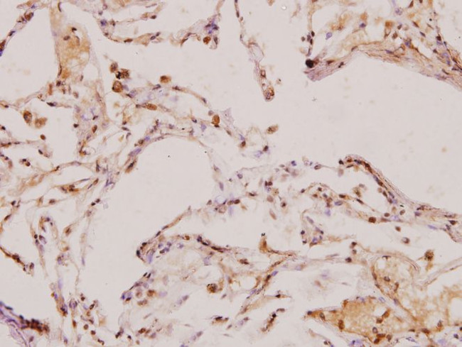 TGF beta-2 Antibody in Immunohistochemistry (Paraffin) (IHC (P))