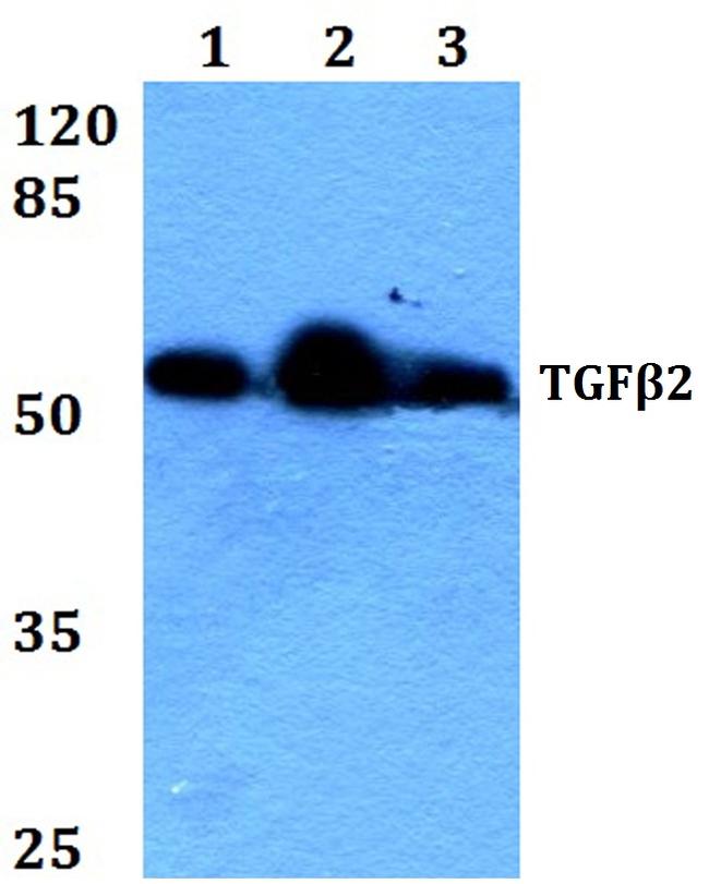 TGF beta-2 Antibody in Western Blot (WB)