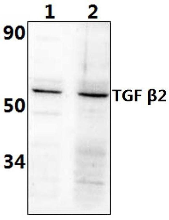 TGF beta-2 Antibody in Western Blot (WB)
