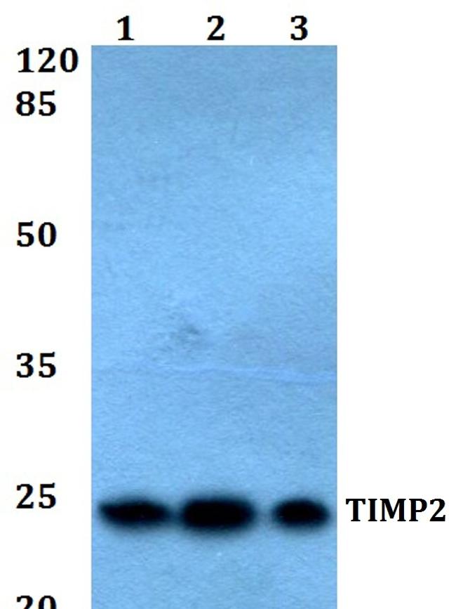 TIMP2 Antibody in Western Blot (WB)