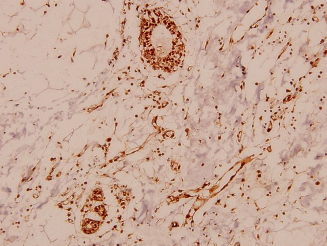 MEF2A Antibody in Immunohistochemistry (Paraffin) (IHC (P))