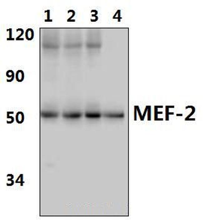 MEF2A Antibody in Western Blot (WB)