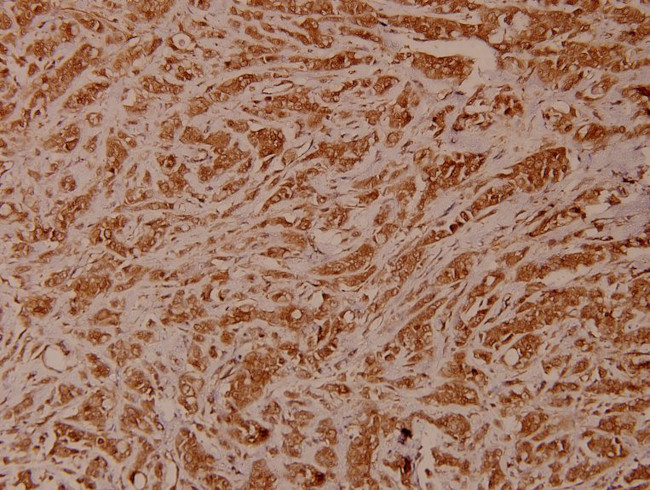 CHK2 Antibody in Immunohistochemistry (Paraffin) (IHC (P))