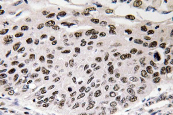 Cyclin D3 Antibody in Immunohistochemistry (Paraffin) (IHC (P))