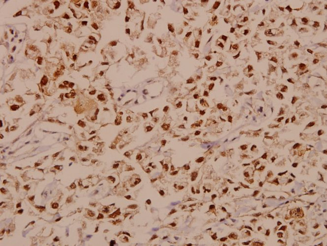 E2F1 Antibody in Immunohistochemistry (Paraffin) (IHC (P))