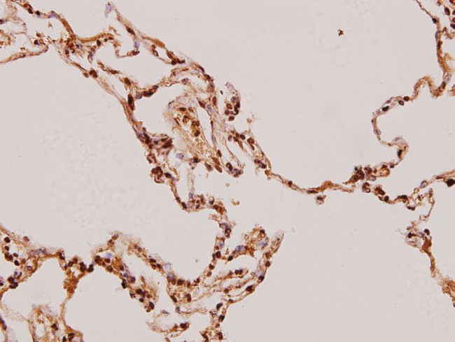 FADD Antibody in Immunohistochemistry (Paraffin) (IHC (P))