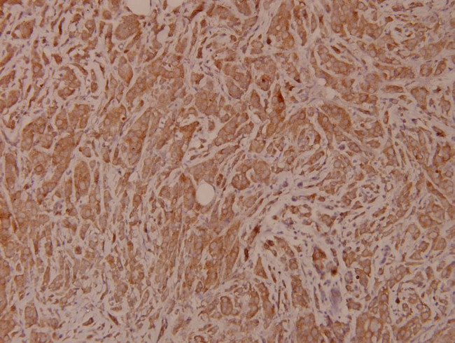 BAD Antibody in Immunohistochemistry (Paraffin) (IHC (P))