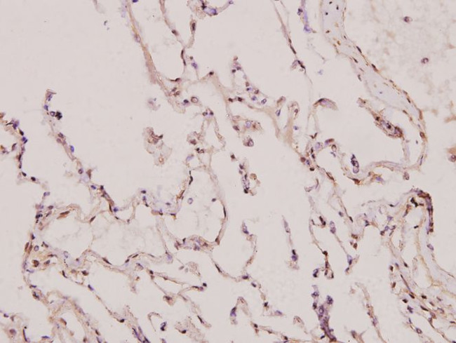 p130Cas Antibody in Immunohistochemistry (Paraffin) (IHC (P))